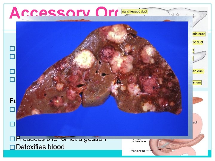 Accessory Organs Liver � Largest gland/solid organ of body; � Located in the RUQ