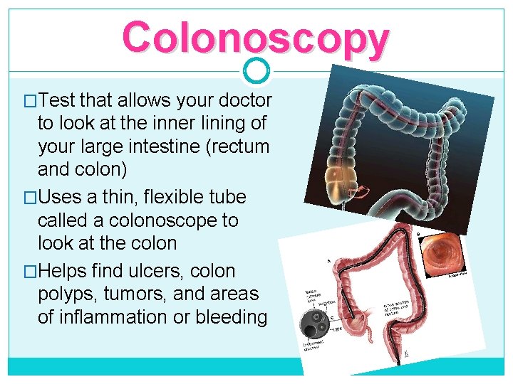 Colonoscopy �Test that allows your doctor to look at the inner lining of your