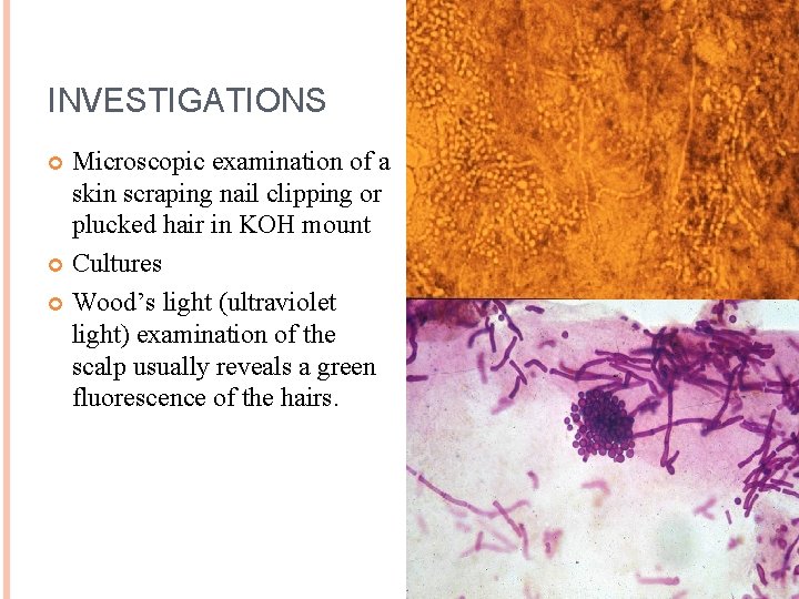 INVESTIGATIONS Microscopic examination of a skin scraping nail clipping or plucked hair in KOH