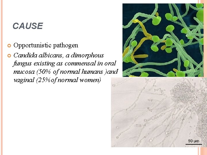 CAUSE Opportunistic pathogen Candida albicans, a dimorphous fungus existing as commensal in oral mucosa