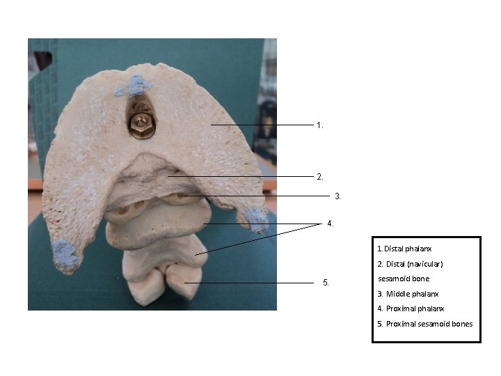 1. 2. 3. 4. 1. Distal phalanx 2. Distal (navicular) 5. sesamoid bone 3.