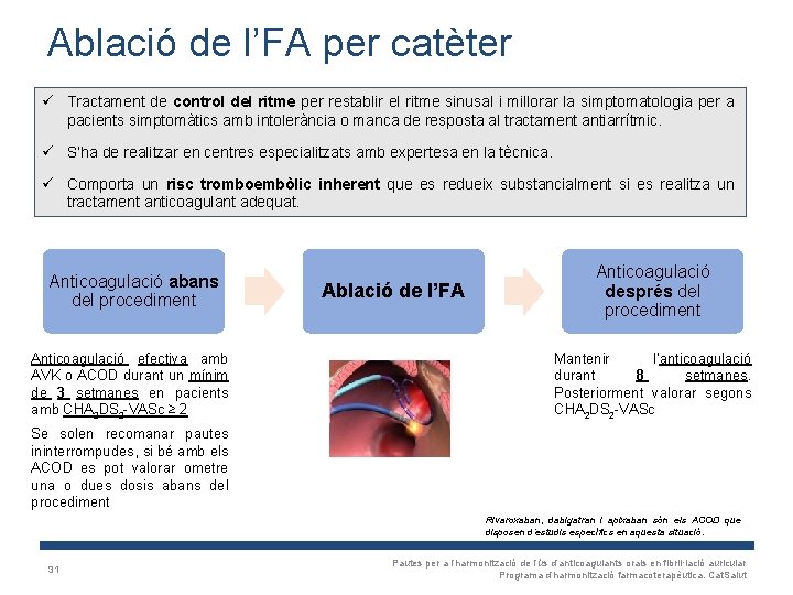 Ablació de l’FA per catèter ü Tractament de control del ritme per restablir el