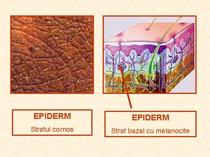 EPIDERM Stratul cornos Strat bazal cu melanocite EPIDERM Stratul cornos Strat bazal cu melanocite