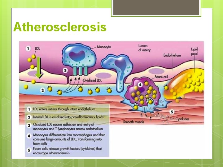 Atherosclerosis Atherosclerosis