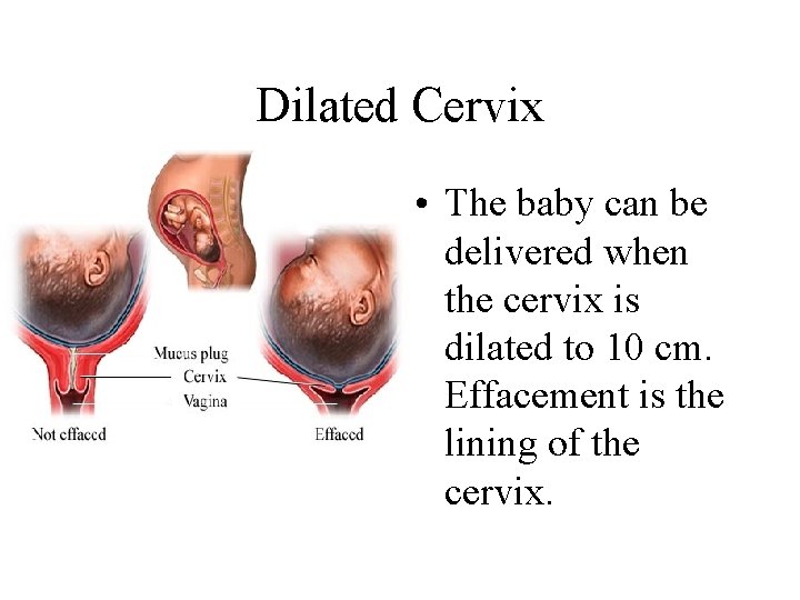 Dilated Cervix • The baby can be delivered when the cervix is dilated to