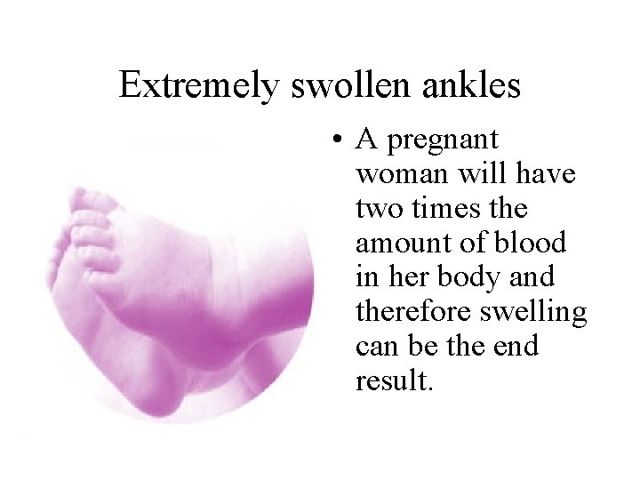 Extremely swollen ankles • A pregnant woman will have two times the amount of