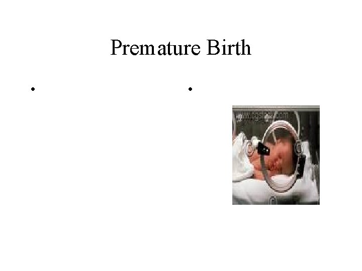 Premature Birth • • 