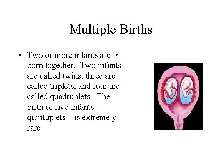 Multiple Births • Two or more infants are • born together. Two infants are