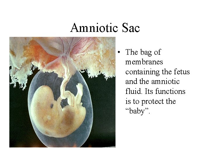 Amniotic Sac • The bag of membranes containing the fetus and the amniotic fluid.