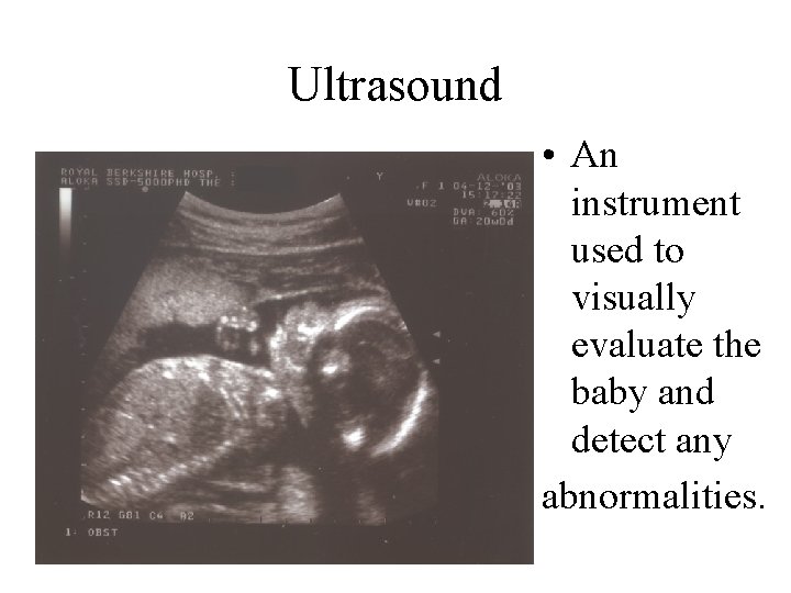 Ultrasound • An instrument used to visually evaluate the baby and detect any abnormalities.