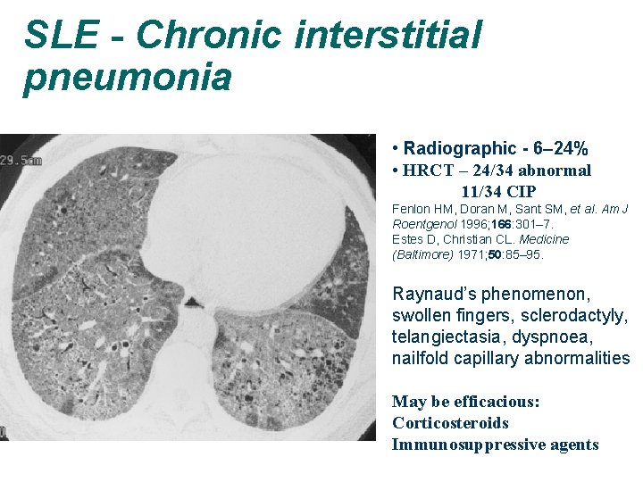 SLE - Chronic interstitial pneumonia • Radiographic - 6– 24% • HRCT – 24/34