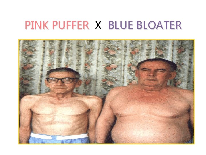 PINK PUFFER X BLUE BLOATER 