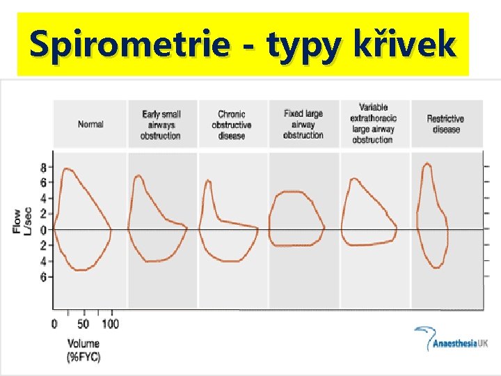 Spirometrie - typy křivek 16 