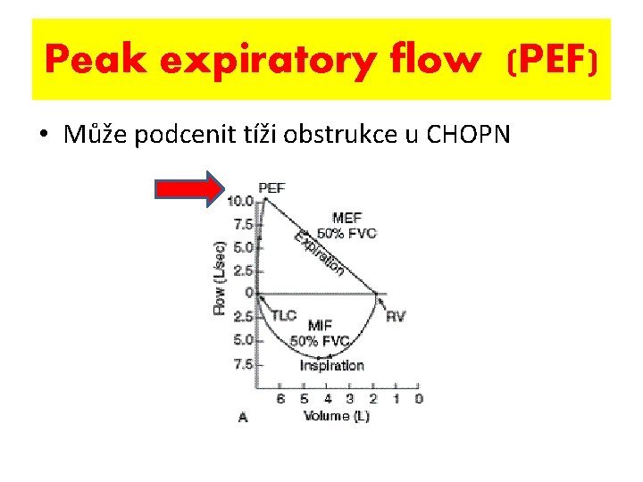 Peak expiratory flow (PEF) • Může podcenit tíži obstrukce u CHOPN 