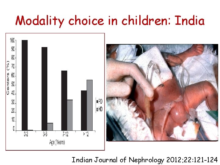 Modality choice in children: Indian Journal of Nephrology 2012; 22: 121 -124 