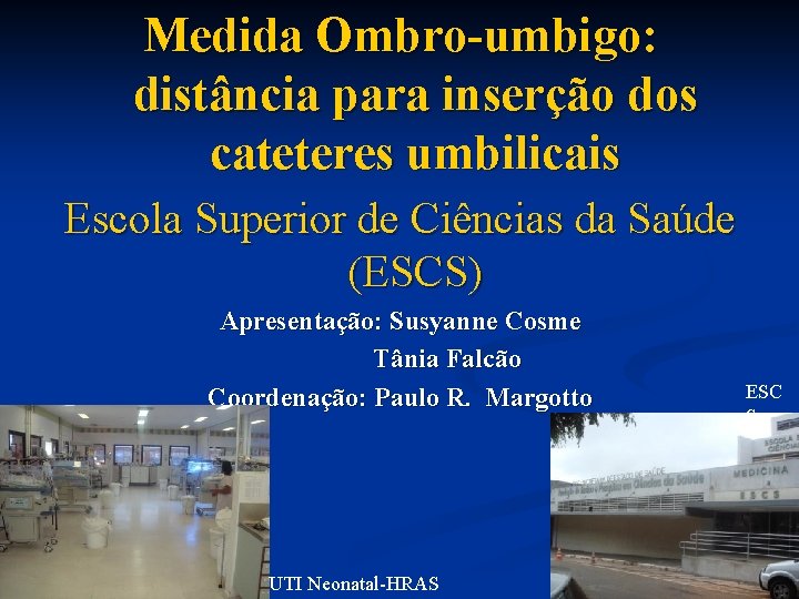 Medida Ombro-umbigo: distância para inserção dos cateteres umbilicais Escola Superior de Ciências da Saúde