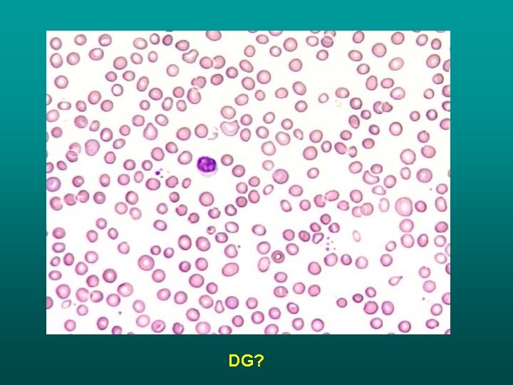 DG? DG?