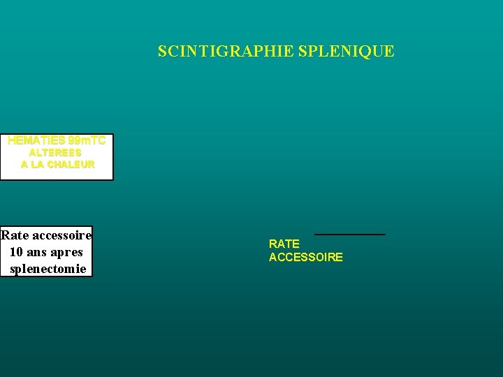 SCINTIGRAPHIE SPLENIQUE HEMATIES 99 m. TC ALTEREES A LA CHALEUR Rate accessoire 10 ans SCINTIGRAPHIE SPLENIQUE HEMATIES 99 m. TC ALTEREES A LA CHALEUR Rate accessoire 10 ans
