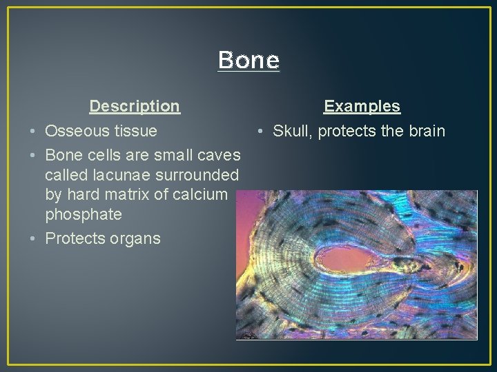 Bone Description Examples • Osseous tissue • Skull, protects the brain • Bone cells