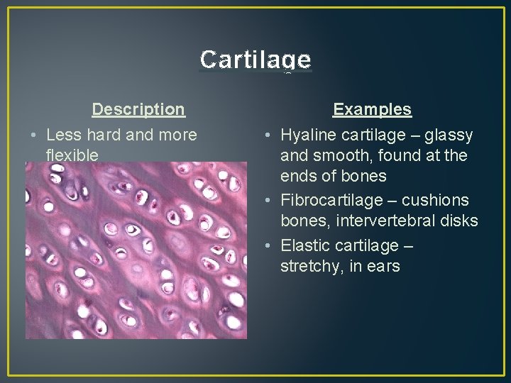 Cartilage Description • Less hard and more flexible Examples • Hyaline cartilage – glassy