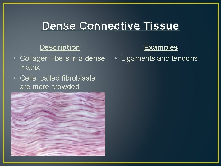 Dense Connective Tissue Description • Collagen fibers in a dense matrix • Cells, called