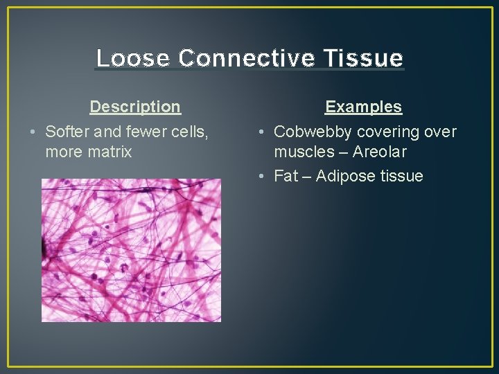 Loose Connective Tissue Description • Softer and fewer cells, more matrix Examples • Cobwebby