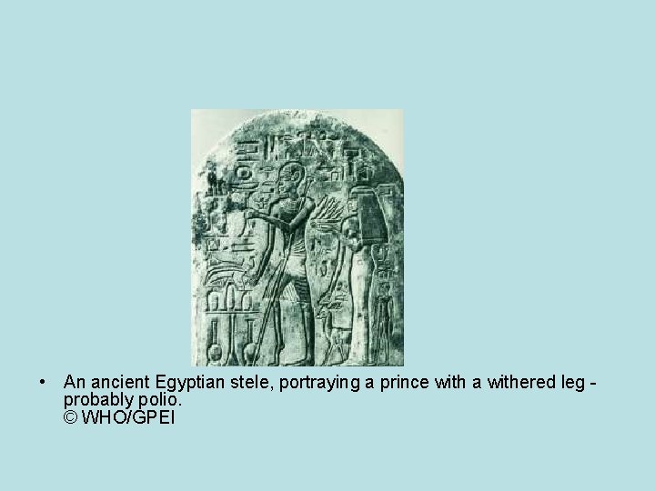  • An ancient Egyptian stele, portraying a prince with a withered leg probably