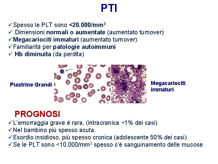 PTI üSpesso le PLT sono <20. 000/mm 3 ü Dimensioni normali o aumentate (aumentato