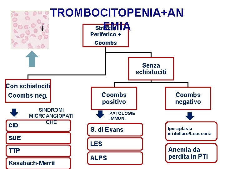 TROMBOCITOPENIA+AN Striscio EMIA Periferico + Coombs Senza schistociti Con schistociti Coombs neg. CID Coombs