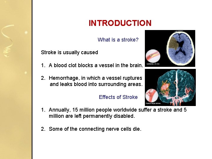 INTRODUCTION What is a stroke? Stroke is usually caused 1. A blood clot blocks INTRODUCTION What is a stroke? Stroke is usually caused 1. A blood clot blocks