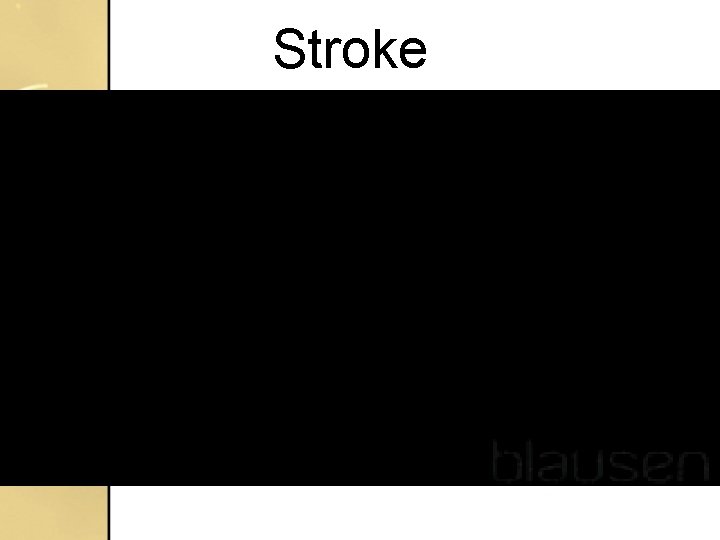 Stroke Stroke