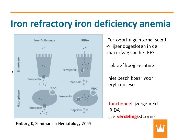 Iron refractory iron deficiency anemia Ferroportin geinternaliseerd -> ijzer opgesloten in de macrofaag van