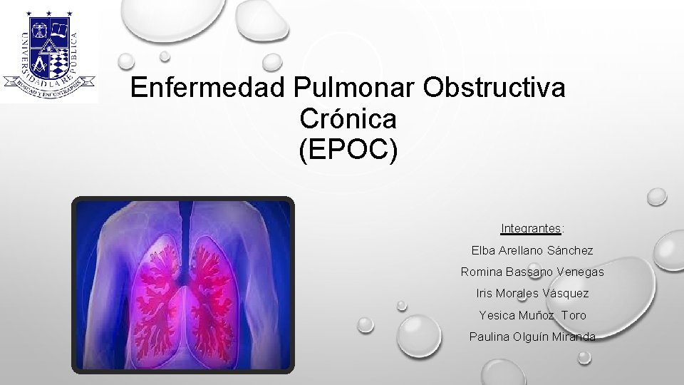 Enfermedad Pulmonar Obstructiva Crónica (EPOC) Integrantes: Elba Arellano Sánchez Romina Bassano Venegas Iris Morales