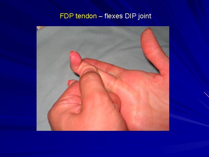 FDP tendon – flexes DIP joint 