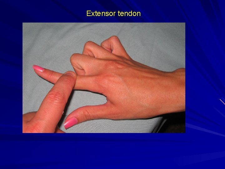 Extensor tendon 