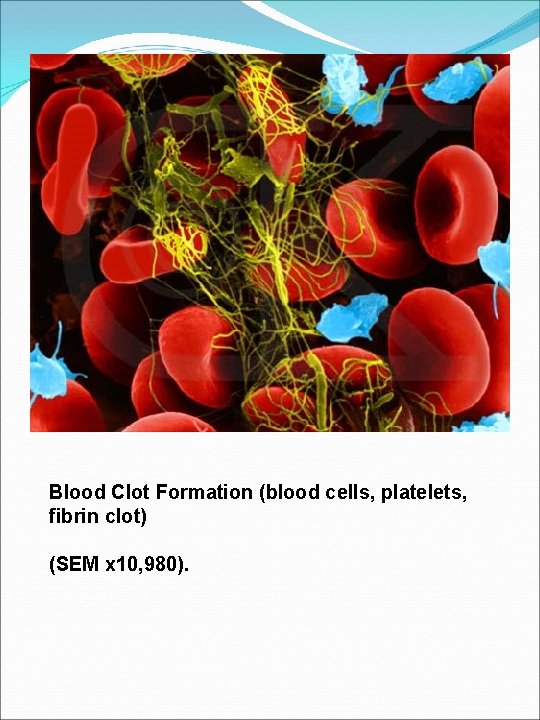 Blood Clot Formation (blood cells, platelets, fibrin clot) (SEM x 10, 980). 