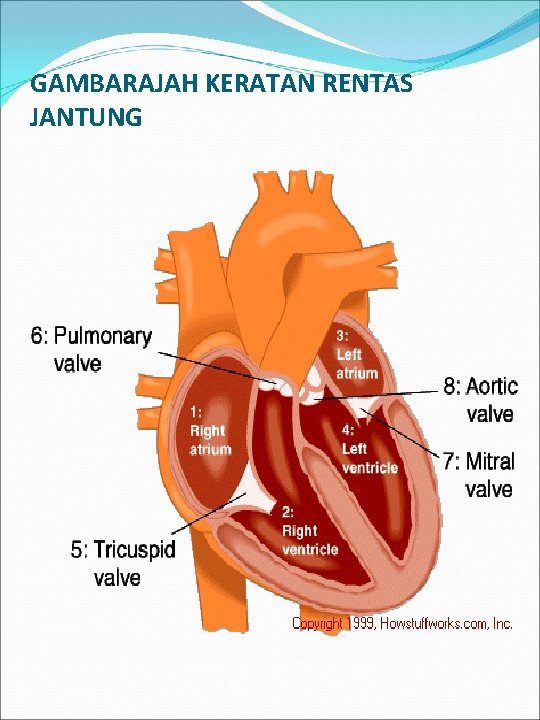 GAMBARAJAH KERATAN RENTAS JANTUNG 