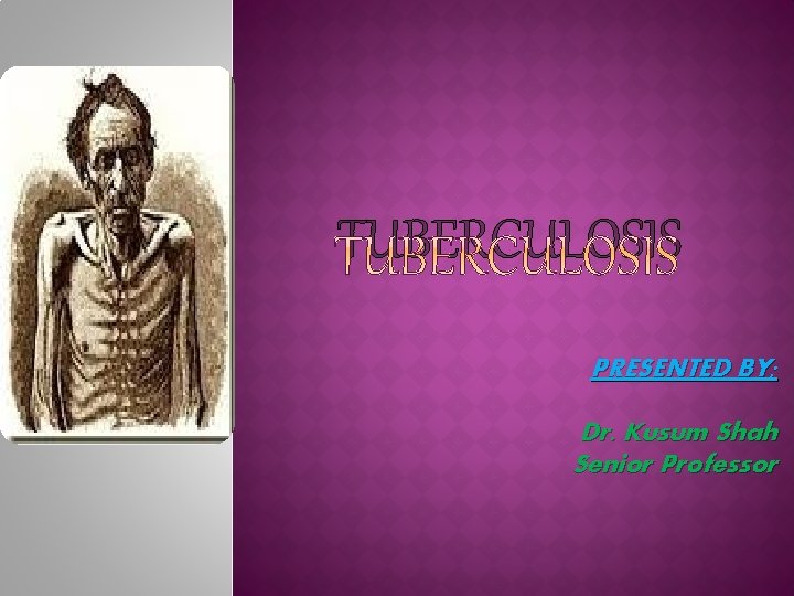 TUBERCULOSIS PRESENTED BY; Dr. Kusum Shah Senior Professor 