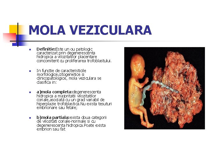 MOLA VEZICULARA n n Definitie: Este un ou patologic caracterizat prin degenerescenta hidropica a