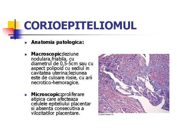 CORIOEPITELIOMUL n n n Anatomia patologica: Macroscopic: leziune nodulara, friabila, cu diametrul de 0,