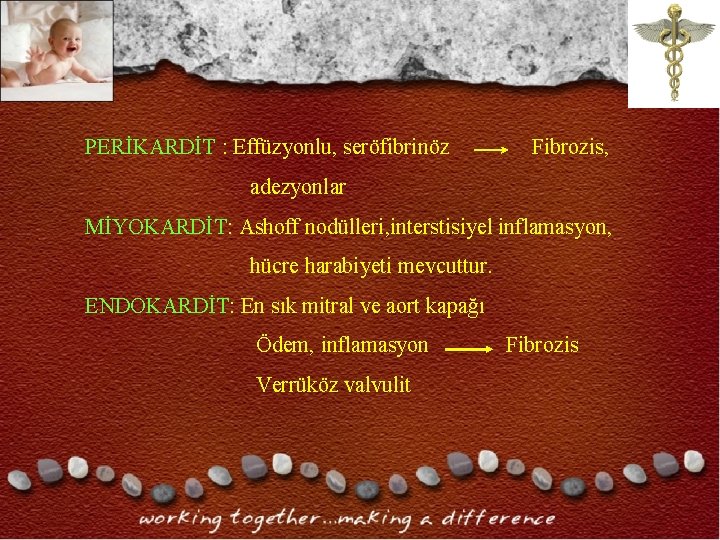 PERİKARDİT : Effüzyonlu, seröfibrinöz Fibrozis, adezyonlar MİYOKARDİT: Ashoff nodülleri, interstisiyel inflamasyon, hücre harabiyeti mevcuttur. PERİKARDİT : Effüzyonlu, seröfibrinöz Fibrozis, adezyonlar MİYOKARDİT: Ashoff nodülleri, interstisiyel inflamasyon, hücre harabiyeti mevcuttur.