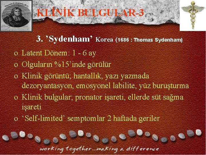 KLİNİK BULGULAR-3 3. ’Sydenham’ Korea (1686 : Thomas Sydenham) o Latent Dönem: 1 - KLİNİK BULGULAR-3 3. ’Sydenham’ Korea (1686 : Thomas Sydenham) o Latent Dönem: 1 -