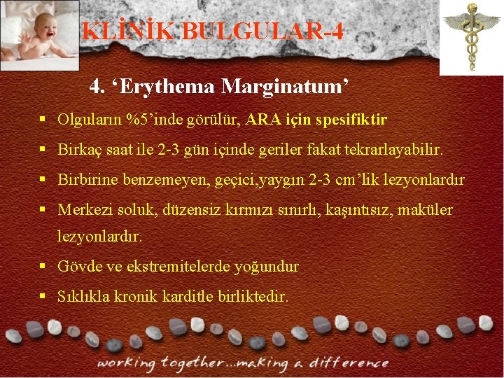KLİNİK BULGULAR-4 4. ‘Erythema Marginatum’ § Olguların %5’inde görülür, ARA için spesifiktir § Birkaç KLİNİK BULGULAR-4 4. ‘Erythema Marginatum’ § Olguların %5’inde görülür, ARA için spesifiktir § Birkaç