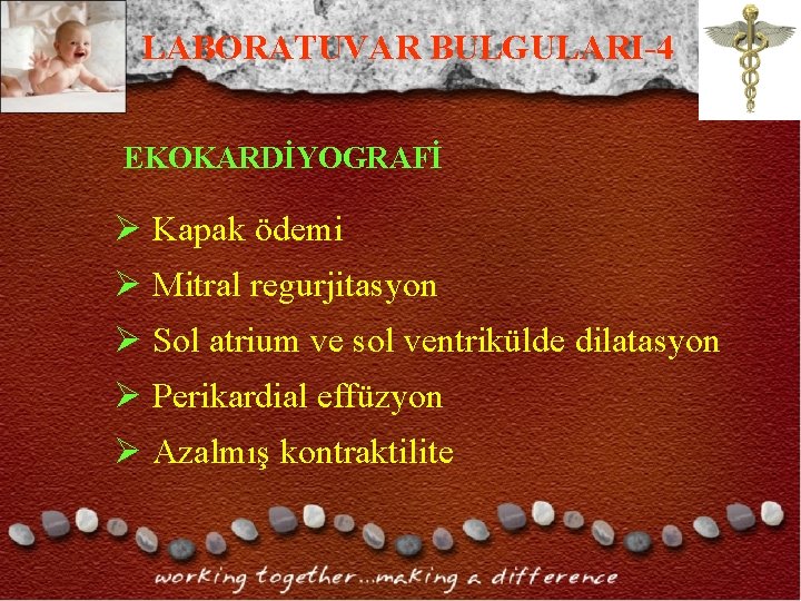 LABORATUVAR BULGULARI-4 EKOKARDİYOGRAFİ Ø Kapak ödemi Ø Mitral regurjitasyon Ø Sol atrium ve sol LABORATUVAR BULGULARI-4 EKOKARDİYOGRAFİ Ø Kapak ödemi Ø Mitral regurjitasyon Ø Sol atrium ve sol