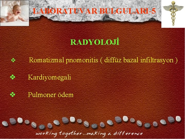 LABORATUVAR BULGULARI-5 RADYOLOJİ v Romatizmal pnomonitis ( diffüz bazal infiltrasyon ) v Kardiyomegali v LABORATUVAR BULGULARI-5 RADYOLOJİ v Romatizmal pnomonitis ( diffüz bazal infiltrasyon ) v Kardiyomegali v