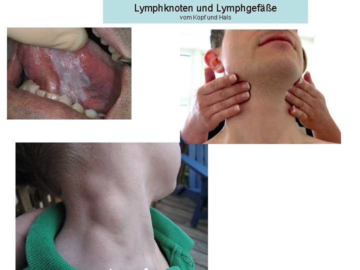 Lymphknoten und Lymphgefäße vom Kopf und Hals 