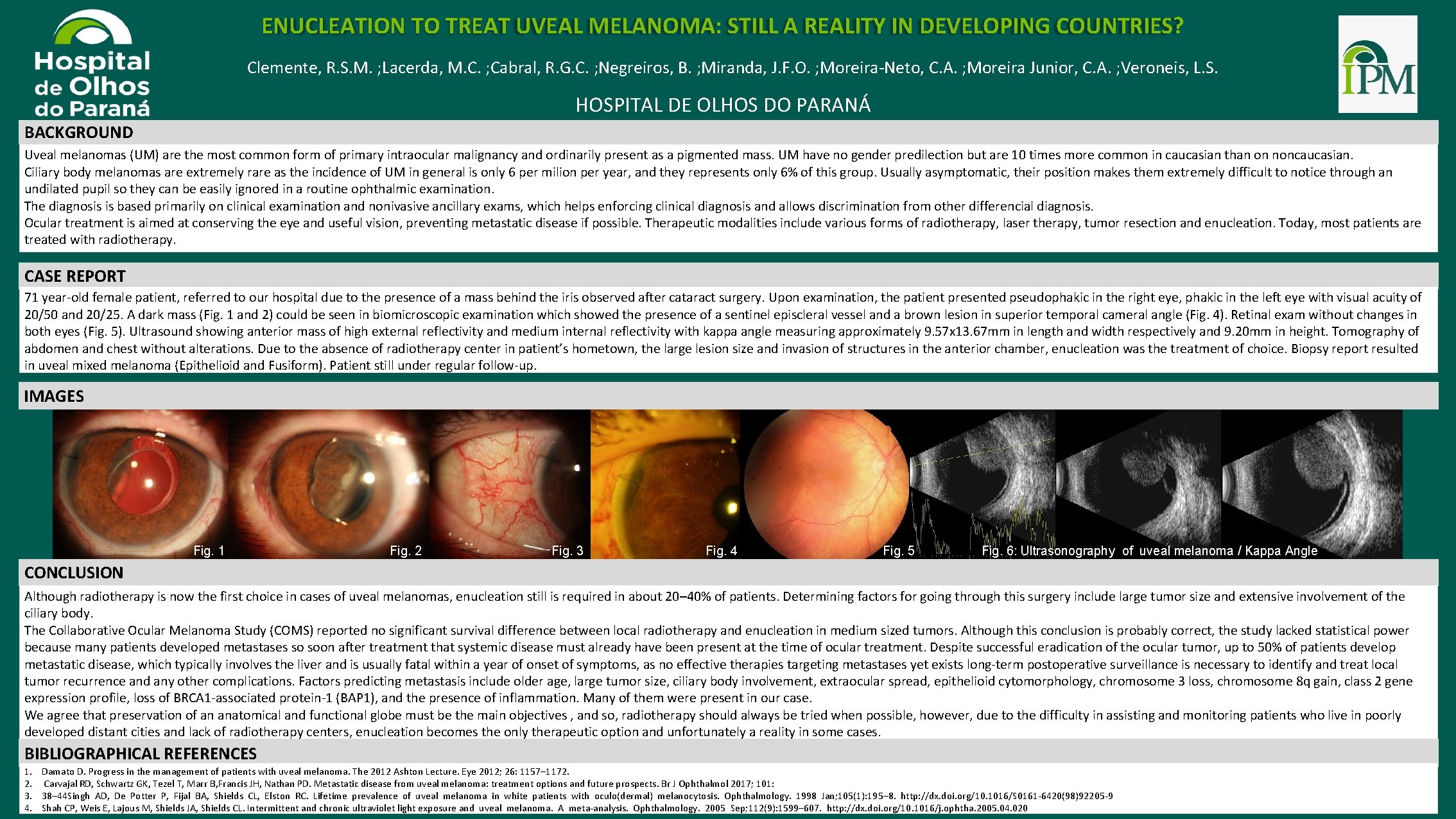 ENUCLEATION TO TREAT UVEAL MELANOMA: STILL A REALITY IN DEVELOPING COUNTRIES? Clemente, R. S.