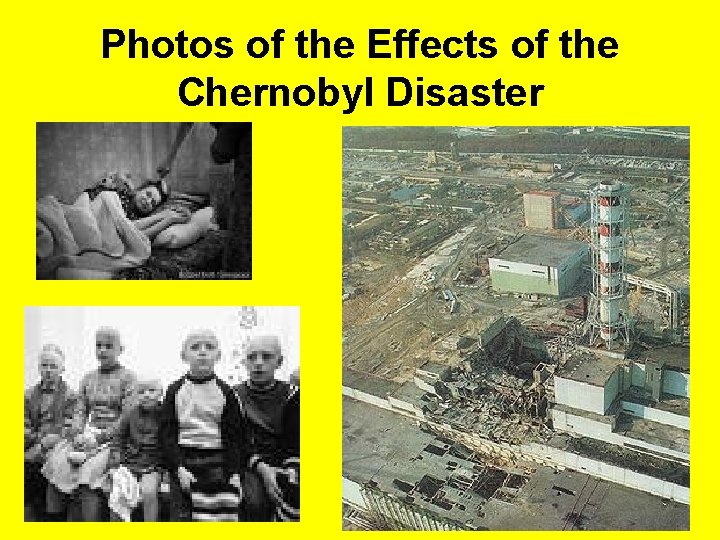 Photos of the Effects of the Chernobyl Disaster 