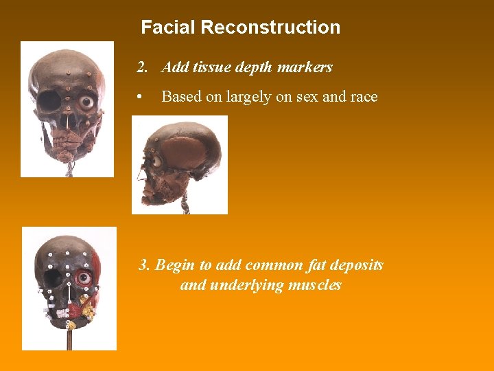 Facial Reconstruction 2. Add tissue depth markers • Based on largely on sex and