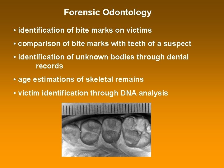 Forensic Odontology • identification of bite marks on victims • comparison of bite marks